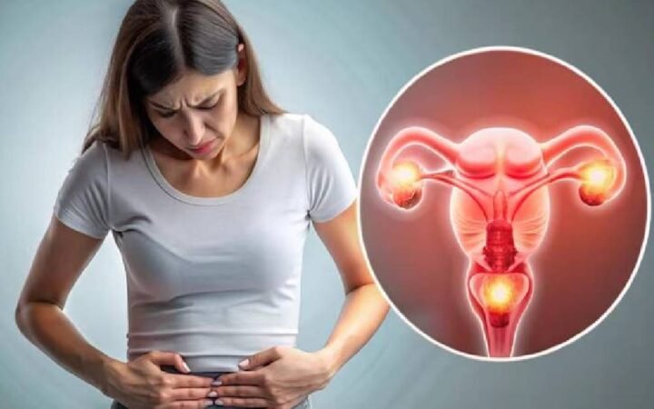 PCOS symptoms and management
