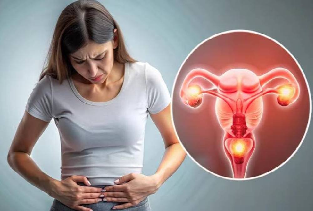 PCOS symptoms and management