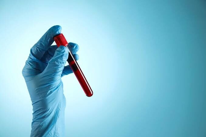 blood test results explained