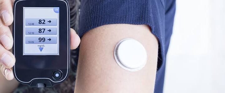 Wearable health devices